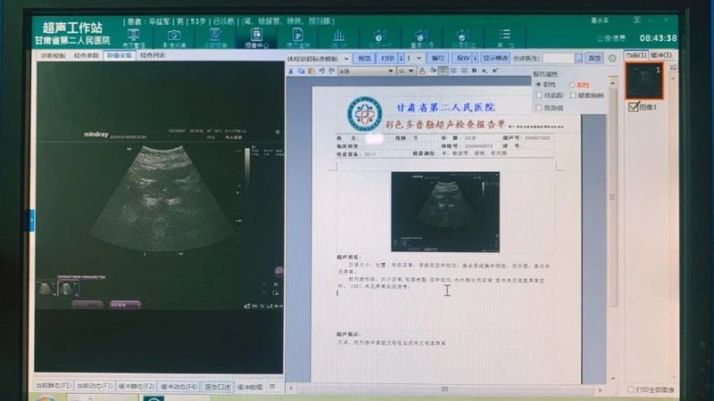 肿瘤基因检测：准确率背后的技术解析